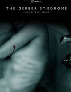 Синдром Гербера