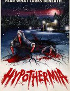 Гипотермия