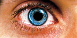 Что делать, если от просмотра фильмов болят глаза